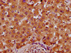 IHC image of CSB-PA018665LA01HU diluted at 1:400 and staining in paraffin-embedded human liver tissue performed on a Leica BondTM system. After dewaxing and hydration, antigen retrieval was mediated by high pressure in a citrate buffer (pH 6.0) . Section was blocked with 10% normal goat serum 30min at RT. Then primary antibody (1% BSA) was incubated at 4°C overnight. The primary is detected by a biotinylated secondary antibody and visualized using an HRP conjugated SP system.