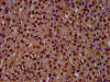 IHC image of CSB-PA019538LA01HU diluted at 1:500 and staining in paraffin-embedded human adrenal gland tissue performed on a Leica BondTM system. After dewaxing and hydration, antigen retrieval was mediated by high pressure in a citrate buffer (pH 6.0) . Section was blocked with 10% normal goat serum 30min at RT. Then primary antibody (1% BSA) was incubated at 4°C overnight. The primary is detected by a biotinylated secondary antibody and visualized using an HRP conjugated SP system.