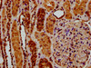 IHC image of CSB-PA020617LA01HU diluted at 1:200 and staining in paraffin-embedded human kidney tissue performed on a Leica BondTM system. After dewaxing and hydration, antigen retrieval was mediated by high pressure in a citrate buffer (pH 6.0) . Section was blocked with 10% normal goat serum 30min at RT. Then primary antibody (1% BSA) was incubated at 4°C overnight. The primary is detected by a biotinylated secondary antibody and visualized using an HRP conjugated SP system.