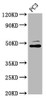 Western Blot<br />
 Positive WB detected in: PC-3 whole cell lysate<br />
 All lanes: SEC14L2 antibody at 4.28µg/ml<br />
 Secondary<br />
 Goat polyclonal to rabbit IgG at 1/50000 dilution<br />
 Predicted band size: 47, 45, 37 kDa<br />
 Observed band size: 47 kDa<br />