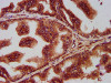 IHC image of CSB-PA020937LA01HU diluted at 1:400 and staining in paraffin-embedded human prostate tissue performed on a Leica BondTM system. After dewaxing and hydration, antigen retrieval was mediated by high pressure in a citrate buffer (pH 6.0) . Section was blocked with 10% normal goat serum 30min at RT. Then primary antibody (1% BSA) was incubated at 4°C overnight. The primary is detected by a biotinylated secondary antibody and visualized using an HRP conjugated SP system.