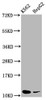 Western Blot<br />
 Positive WB detected in: K562 whole cell lysate, HepG2 whole cell lysate<br />
 All lanes: SNRPE antibody at 5.2µg/ml<br />
 Secondary<br />
 Goat polyclonal to rabbit IgG at 1/50000 dilution<br />
 Predicted band size: 11 kDa<br />
 Observed band size: 11 kDa<br /> Western Blot<br />
 Positive WB detected in: K562 whole cell lysate, HepG2 whole cell lysate<br />
 All lanes: SNRPE antibody at 5.2µg/ml<br />
 Secondary<br />
 Goat polyclonal to rabbit IgG at 1/50000 dilution<br />
 Predicted band size: 11 kDa<br />
 Observed band size: 11 kDa<br />