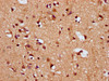 IHC image of CSB-PA022336LA01HU diluted at 1:200 and staining in paraffin-embedded human brain tissue performed on a Leica BondTM system. After dewaxing and hydration, antigen retrieval was mediated by high pressure in a citrate buffer (pH 6.0) . Section was blocked with 10% normal goat serum 30min at RT. Then primary antibody (1% BSA) was incubated at 4°C overnight. The primary is detected by a biotinylated secondary antibody and visualized using an HRP conjugated SP system.