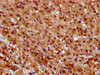 IHC image of CSB-PA022919LA01HU diluted at 1:600 and staining in paraffin-embedded human adrenal gland tissue performed on a Leica BondTM system. After dewaxing and hydration, antigen retrieval was mediated by high pressure in a citrate buffer (pH 6.0) . Section was blocked with 10% normal goat serum 30min at RT. Then primary antibody (1% BSA) was incubated at 4°C overnight. The primary is detected by a biotinylated secondary antibody and visualized using an HRP conjugated SP system.