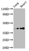 Western Blot<br />
 Positive WB detected in: Rat lung tissue, Rat heart tissue<br />
 All lanes: TUSC3 antibody at 4.7µg/ml<br />
 Secondary<br />
 Goat polyclonal to rabbit IgG at 1/50000 dilution<br />
 Predicted band size: 40 kDa<br />
 Observed band size: 40 kDa<br />