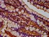 IHC image of CSB-PA025352LA01HU diluted at 1:300 and staining in paraffin-embedded human small intestine tissue performed on a Leica BondTM system. After dewaxing and hydration, antigen retrieval was mediated by high pressure in a citrate buffer (pH 6.0) . Section was blocked with 10% normal goat serum 30min at RT. Then primary antibody (1% BSA) was incubated at 4°C overnight. The primary is detected by a biotinylated secondary antibody and visualized using an HRP conjugated SP system.