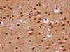 IHC image of CSB-PA22879A0Rb diluted at 1:300 and staining in paraffin-embedded human brain tissue performed on a Leica BondTM system. After dewaxing and hydration, antigen retrieval was mediated by high pressure in a citrate buffer (pH 6.0) . Section was blocked with 10% normal goat serum 30min at RT. Then primary antibody (1% BSA) was incubated at 4°C overnight. The primary is detected by a biotinylated secondary antibody and visualized using an HRP conjugated SP system.