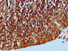 IHC image of CSB-PA22879A0Rb diluted at 1:300 and staining in paraffin-embedded human lung tissue performed on a Leica BondTM system. After dewaxing and hydration, antigen retrieval was mediated by high pressure in a citrate buffer (pH 6.0) . Section was blocked with 10% normal goat serum 30min at RT. Then primary antibody (1% BSA) was incubated at 4°C overnight. The primary is detected by a biotinylated secondary antibody and visualized using an HRP conjugated SP system.