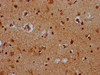 IHC image of CSB-PA729212LA01HU diluted at 1:400 and staining in paraffin-embedded human brain tissue performed on a Leica BondTM system. After dewaxing and hydration, antigen retrieval was mediated by high pressure in a citrate buffer (pH 6.0) . Section was blocked with 10% normal goat serum 30min at RT. Then primary antibody (1% BSA) was incubated at 4°C overnight. The primary is detected by a biotinylated secondary antibody and visualized using an HRP conjugated SP system.