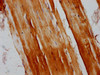 IHC image of CSB-PA764955LA01HU diluted at 1:200 and staining in paraffin-embedded human skeletal muscle tissue performed on a Leica BondTM system. After dewaxing and hydration, antigen retrieval was mediated by high pressure in a citrate buffer (pH 6.0) . Section was blocked with 10% normal goat serum 30min at RT. Then primary antibody (1% BSA) was incubated at 4°C overnight. The primary is detected by a biotinylated secondary antibody and visualized using an HRP conjugated SP system.