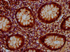 IHC image of CSB-PA769767LA01HU diluted at 1:500 and staining in paraffin-embedded human appendix tissue performed on a Leica BondTM system. After dewaxing and hydration, antigen retrieval was mediated by high pressure in a citrate buffer (pH 6.0) . Section was blocked with 10% normal goat serum 30min at RT. Then primary antibody (1% BSA) was incubated at 4°C overnight. The primary is detected by a biotinylated secondary antibody and visualized using an HRP conjugated SP system.