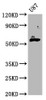 Western Blot<br />
 Positive WB detected in: U87 whole cell lysate<br />
 All lanes: GPT2 antibody at 4.5µg/ml<br />
 Secondary<br />
 Goat polyclonal to rabbit IgG at 1/50000 dilution<br />
 Predicted band size: 58, 47 kDa<br />
 Observed band size: 58 kDa<br />