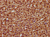 IHC image of CSB-PA835687LA01HU diluted at 1:400 and staining in paraffin-embedded human adrenal gland tissue performed on a Leica BondTM system. After dewaxing and hydration, antigen retrieval was mediated by high pressure in a citrate buffer (pH 6.0) . Section was blocked with 10% normal goat serum 30min at RT. Then primary antibody (1% BSA) was incubated at 4°C overnight. The primary is detected by a biotinylated secondary antibody and visualized using an HRP conjugated SP system.