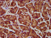 IHC image of CSB-PA836275LA01HU diluted at 1:300 and staining in paraffin-embedded human pancreatic cancer performed on a Leica BondTM system. After dewaxing and hydration, antigen retrieval was mediated by high pressure in a citrate buffer (pH 6.0) . Section was blocked with 10% normal goat serum 30min at RT. Then primary antibody (1% BSA) was incubated at 4°C overnight. The primary is detected by a biotinylated secondary antibody and visualized using an HRP conjugated SP system.