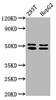 Western Blot<br />
 Positive WB detected in: 293T whole cell lysate, HepG2 whole cell lysate<br />
 All lanes: TRNT1 antibody at 5µg/ml<br />
 Secondary<br />
 Goat polyclonal to rabbit IgG at 1/50000 dilution<br />
 Predicted band size: 51, 48, 7 kDa<br />
 Observed band size: 51, 48 kDa<br />