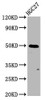 Western Blot<br />
 Positive WB detected in: HGC27 whole cell lysate<br />
 All lanes: GSDMA antibody at 3.85µg/ml<br />
 Secondary<br />
 Goat polyclonal to rabbit IgG at 1/50000 dilution<br />
 Predicted band size: 50 kDa<br />
 Observed band size: 50 kDa<br />