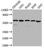 Western Blot<br />
 Positive WB detected in: Colo320 whole cell lysate, U251 whole cell lysate, HepG2 whole cell lysate, A549 whole cell lysate, 293T whole cell lysate<br />
 All lanes: CLCC1 antibody at 3.7µg/ml<br />
 Secondary<br />
 Goat polyclonal to rabbit IgG at 1/50000 dilution<br />
 Predicted band size: 63, 57, 48, 40 kDa<br />
 Observed band size: 63 kDa<br />