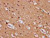 IHC image of CSB-PA862010LA01HU diluted at 1:100 and staining in paraffin-embedded human brain tissue performed on a Leica BondTM system. After dewaxing and hydration, antigen retrieval was mediated by high pressure in a citrate buffer (pH 6.0) . Section was blocked with 10% normal goat serum 30min at RT. Then primary antibody (1% BSA) was incubated at 4°C overnight. The primary is detected by a biotinylated secondary antibody and visualized using an HRP conjugated SP system.