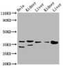 Western Blot<br />
 Positive WB detected in: Hela whole cell lysate, Rat kidney tissue, Rat liver tissue, Mouse kidney tissue, Mouse liver tissue<br />
 All lanes: PPA2 antibody at 3.1µg/ml<br />
 Secondary<br />
 Goat polyclonal to rabbit IgG at 1/50000 dilution<br />
 Predicted band size: 38, 40, 35, 19, 26 kDa<br />
 Observed band size: 38 kDa<br />