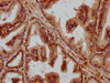 IHC image of CSB-PA867137LA01HU diluted at 1:200 and staining in paraffin-embedded human prostate tissue performed on a Leica BondTM system. After dewaxing and hydration, antigen retrieval was mediated by high pressure in a citrate buffer (pH 6.0) . Section was blocked with 10% normal goat serum 30min at RT. Then primary antibody (1% BSA) was incubated at 4°C overnight. The primary is detected by a biotinylated secondary antibody and visualized using an HRP conjugated SP system.