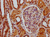 IHC image of CSB-PA880121LA01HU diluted at 1:600 and staining in paraffin-embedded human kidney tissue performed on a Leica BondTM system. After dewaxing and hydration, antigen retrieval was mediated by high pressure in a citrate buffer (pH 6.0) . Section was blocked with 10% normal goat serum 30min at RT. Then primary antibody (1% BSA) was incubated at 4°C overnight. The primary is detected by a biotinylated secondary antibody and visualized using an HRP conjugated SP system.
