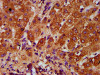 IHC image of CSB-PA883373LA01HU diluted at 1:400 and staining in paraffin-embedded human liver tissue performed on a Leica BondTM system. After dewaxing and hydration, antigen retrieval was mediated by high pressure in a citrate buffer (pH 6.0) . Section was blocked with 10% normal goat serum 30min at RT. Then primary antibody (1% BSA) was incubated at 4°C overnight. The primary is detected by a biotinylated secondary antibody and visualized using an HRP conjugated SP system.