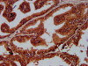 IHC image of CSB-PA883386LA01HU diluted at 1:200 and staining in paraffin-embedded human prostate tissue performed on a Leica BondTM system. After dewaxing and hydration, antigen retrieval was mediated by high pressure in a citrate buffer (pH 6.0) . Section was blocked with 10% normal goat serum 30min at RT. Then primary antibody (1% BSA) was incubated at 4°C overnight. The primary is detected by a biotinylated secondary antibody and visualized using an HRP conjugated SP system.