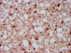 IHC image of CSB-PA889188LA01HU diluted at 1:500 and staining in paraffin-embedded human brain tissue performed on a Leica BondTM system. After dewaxing and hydration, antigen retrieval was mediated by high pressure in a citrate buffer (pH 6.0) . Section was blocked with 10% normal goat serum 30min at RT. Then primary antibody (1% BSA) was incubated at 4°C overnight. The primary is detected by a biotinylated secondary antibody and visualized using an HRP conjugated SP system.