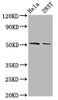 Western Blot<br />
 Positive WB detected in: Hela whole cell lysate, 293T whole cell lysate<br />
 All lanes: PLAGL2 antibody at 3.8µg/ml<br />
 Secondary<br />
 Goat polyclonal to rabbit IgG at 1/50000 dilution<br />
 Predicted band size: 55 kDa<br />
 Observed band size: 55 kDa<br />