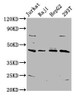 Western Blot<br />
 Positive WB detected in: Jurkat whole cell lysate, Raji whole cell lysate, HepG2 whole cell lysate, 293T whole cell lysate<br />
 All lanes: SPO11 antibody at 5.8µg/ml<br />
 Secondary<br />
 Goat polyclonal to rabbit IgG at 1/50000 dilution<br />
 Predicted band size: 45, 41 kDa<br />
 Observed band size: 45 kDa<br /> Western Blot<br />
 Positive WB detected in: Jurkat whole cell lysate, Raji whole cell lysate, HepG2 whole cell lysate, 293T whole cell lysate<br />
 All lanes: SPO11 antibody at 5.8µg/ml<br />
 Secondary<br />
 Goat polyclonal to rabbit IgG at 1/50000 dilution<br />
 Predicted band size: 45, 41 kDa<br />
 Observed band size: 45 kDa<br />