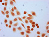 Immunocytochemistry analysis of CSB-PA010429OA77forHU diluted at 1:30 and staining in Hela cells (treated with 30mM sodium butyrate for 4h) performed on a Leica BondTM system. The cells were fixed in 4% formaldehyde, permeabilized using 0.2% Triton X-100 and blocked with 10% normal goat serum 30min at RT. Then primary antibody (1% BSA) was incubated at 4°C overnight. The primary is detected by a biotinylated secondary antibody and visualized using an HRP conjugated SP system.