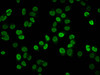 Immunofluorescence staining of Hela cells (treated with 10mM sodium propionate for 4h) with CSB-PA010429OA08propHU at 1:25, counter-stained with DAPI. The cells were fixed in 4% formaldehyde, permeabilized using 0.2% Triton X-100 and blocked in 10% normal Goat Serum. The cells were then incubated with the antibody overnight at 4°C. The secondary antibody was Alexa Fluor 488-congugated AffiniPure Goat Anti-Rabbit IgG (H+L) .