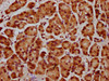 IHC image of CSB-PA010429OA31nsucHU diluted at 1:20 and staining in paraffin-embedded human pancreatic cancer performed on a Leica BondTM system. After dewaxing and hydration, antigen retrieval was mediated by high pressure in a citrate buffer (pH 6.0) . Section was blocked with 10% normal goat serum 30min at RT. Then primary antibody (1% BSA) was incubated at 4°C overnight. The primary is detected by a biotinylated secondary antibody and visualized using an HRP conjugated SP system.