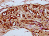 IHC image of CSB-PA010429OA79npropHU diluted at 1:20 and staining in paraffin-embedded human breast cancer performed on a Leica BondTM system. After dewaxing and hydration, antigen retrieval was mediated by high pressure in a citrate buffer (pH 6.0) . Section was blocked with 10% normal goat serum 30min at RT. Then primary antibody (1% BSA) was incubated at 4°C overnight. The primary is detected by a biotinylated secondary antibody and visualized using an HRP conjugated SP system.