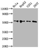 Western Blot<br />
 Positive WB detected in: Hela whole cell lysate, HepG2 whole cell lysate, U251 whole cell lysate, 293T whole cell lysate<br />
 All lanes: CCT6A antibody at 4.2µg/ml<br />
 Secondary<br />
 Goat polyclonal to rabbit IgG at 1/50000 dilution<br />
 Predicted band size: 59, 54 kDa<br />
 Observed band size: 59 kDa<br />