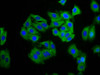 Immunofluorescence staining of HepG2 cells with CSB-PA005909LA01HU at 1:100, counter-stained with DAPI. The cells were fixed in 4% formaldehyde, permeabilized using 0.2% Triton X-100 and blocked in 10% normal Goat Serum. The cells were then incubated with the antibody overnight at 4°C. The secondary antibody was Alexa Fluor 488-congugated AffiniPure Goat Anti-Rabbit IgG (H+L) . Immunofluorescence staining of HepG2 cells with CSB-PA005909LA01HU at 1:100, counter-stained with DAPI. The cells were fixed in 4% formaldehyde, permeabilized using 0.2% Triton X-100 and blocked in 10% normal Goat Serum. The cells were then incubated with the antibody overnight at 4°C. The secondary antibody was Alexa Fluor 488-congugated AffiniPure Goat Anti-Rabbit IgG (H+L) .
