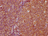 IHC image of CSB-PA008345LA01HU diluted at 1:400 and staining in paraffin-embedded human tonsil tissue performed on a Leica BondTM system. After dewaxing and hydration, antigen retrieval was mediated by high pressure in a citrate buffer (pH 6.0) . Section was blocked with 10% normal goat serum 30min at RT. Then primary antibody (1% BSA) was incubated at 4°C overnight. The primary is detected by a biotinylated secondary antibody and visualized using an HRP conjugated SP system.