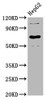 Western Blot<br />
 Positive WB detected in: HepG2 whole cell lysate<br />
 All lanes: LILRB3 antibody at 3.9µg/ml<br />
 Secondary<br />
 Goat polyclonal to rabbit IgG at 1/50000 dilution<br />
 Predicted band size: 70, 72 kDa<br />
 Observed band size: 70 kDa<br />