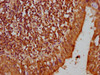 IHC image of CSB-PA013675LA01HU diluted at 1:200 and staining in paraffin-embedded human lung tissue performed on a Leica BondTM system. After dewaxing and hydration, antigen retrieval was mediated by high pressure in a citrate buffer (pH 6.0) . Section was blocked with 10% normal goat serum 30min at RT. Then primary antibody (1% BSA) was incubated at 4°C overnight. The primary is detected by a biotinylated secondary antibody and visualized using an HRP conjugated SP system.