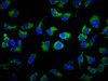 Immunofluorescence staining of A549 cells with CSB-PA015013LA01HU at 1:133, counter-stained with DAPI. The cells were fixed in 4% formaldehyde, permeabilized using 0.2% Triton X-100 and blocked in 10% normal Goat Serum. The cells were then incubated with the antibody overnight at 4°C. The secondary antibody was Alexa Fluor 488-congugated AffiniPure Goat Anti-Rabbit IgG (H+L) .