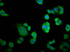 Immunofluorescence staining of PC-3 cells with CSB-PA015673LA01HU at 1:133, counter-stained with DAPI. The cells were fixed in 4% formaldehyde, permeabilized using 0.2% Triton X-100 and blocked in 10% normal Goat Serum. The cells were then incubated with the antibody overnight at 4°C. The secondary antibody was Alexa Fluor 488-congugated AffiniPure Goat Anti-Rabbit IgG (H+L) .