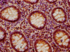 IHC image of CSB-PA019045LA01HU diluted at 1:400 and staining in paraffin-embedded human appendix tissue performed on a Leica BondTM system. After dewaxing and hydration, antigen retrieval was mediated by high pressure in a citrate buffer (pH 6.0) . Section was blocked with 10% normal goat serum 30min at RT. Then primary antibody (1% BSA) was incubated at 4°C overnight. The primary is detected by a biotinylated secondary antibody and visualized using an HRP conjugated SP system.