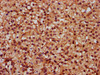 IHC image of CSB-PA021525LA01HU diluted at 1:300 and staining in paraffin-embedded human adrenal gland tissue performed on a Leica BondTM system. After dewaxing and hydration, antigen retrieval was mediated by high pressure in a citrate buffer (pH 6.0) . Section was blocked with 10% normal goat serum 30min at RT. Then primary antibody (1% BSA) was incubated at 4°C overnight. The primary is detected by a biotinylated secondary antibody and visualized using an HRP conjugated SP system.
