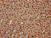 IHC image of CSB-PA023291LA01HU diluted at 1:300 and staining in paraffin-embedded human adrenal gland tissue performed on a Leica BondTM system. After dewaxing and hydration, antigen retrieval was mediated by high pressure in a citrate buffer (pH 6.0) . Section was blocked with 10% normal goat serum 30min at RT. Then primary antibody (1% BSA) was incubated at 4°C overnight. The primary is detected by a biotinylated secondary antibody and visualized using an HRP conjugated SP system.