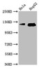 Western Blot<br />
 Positive WB detected in: Hela whole cell lysate, HepG2 whole cell lysate<br />
 All lanes: TMF1 antibody at 3.7µg/ml<br />
 Secondary<br />
 Goat polyclonal to rabbit IgG at 1/50000 dilution<br />
 Predicted band size: 123, 124 kDa<br />
 Observed band size: 123, 124 kDa<br />