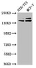 Western Blot<br />
 Positive WB detected in: NIH/3T3 whole cell lysate, MCF-7 whole cell lysate<br />
 All lanes: UMODL1 antibody at 5.1µg/ml<br />
 Secondary<br />
 Goat polyclonal to rabbit IgG at 1/50000 dilution<br />
 Predicted band size: 145, 157, 137, 150 kDa<br />
 Observed band size: 145, 157 kDa<br />