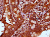 IHC image of CSB-PA623928LA01HU diluted at 1:400 and staining in paraffin-embedded human small intestine tissue performed on a Leica BondTM system. After dewaxing and hydration, antigen retrieval was mediated by high pressure in a citrate buffer (pH 6.0) . Section was blocked with 10% normal goat serum 30min at RT. Then primary antibody (1% BSA) was incubated at 4°C overnight. The primary is detected by a biotinylated secondary antibody and visualized using an HRP conjugated SP system.