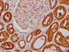 IHC image of CSB-PA623928LA01HU diluted at 1:400 and staining in paraffin-embedded human kidney tissue performed on a Leica BondTM system. After dewaxing and hydration, antigen retrieval was mediated by high pressure in a citrate buffer (pH 6.0) . Section was blocked with 10% normal goat serum 30min at RT. Then primary antibody (1% BSA) was incubated at 4°C overnight. The primary is detected by a biotinylated secondary antibody and visualized using an HRP conjugated SP system.