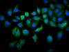 Immunofluorescence staining of A549 cells with CSB-PA623928LA01HU at 1:133, counter-stained with DAPI. The cells were fixed in 4% formaldehyde, permeabilized using 0.2% Triton X-100 and blocked in 10% normal Goat Serum. The cells were then incubated with the antibody overnight at 4°C. The secondary antibody was Alexa Fluor 488-congugated AffiniPure Goat Anti-Rabbit IgG (H+L) .