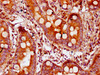 IHC image of CSB-PA810285LA01HU diluted at 1:300 and staining in paraffin-embedded human small intestine tissue performed on a Leica BondTM system. After dewaxing and hydration, antigen retrieval was mediated by high pressure in a citrate buffer (pH 6.0) . Section was blocked with 10% normal goat serum 30min at RT. Then primary antibody (1% BSA) was incubated at 4°C overnight. The primary is detected by a biotinylated secondary antibody and visualized using an HRP conjugated SP system.